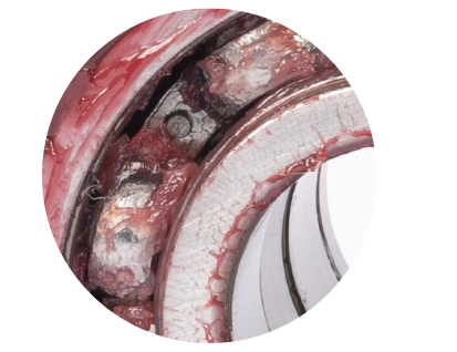 Lagerlösningar med ILS-teknologi 3